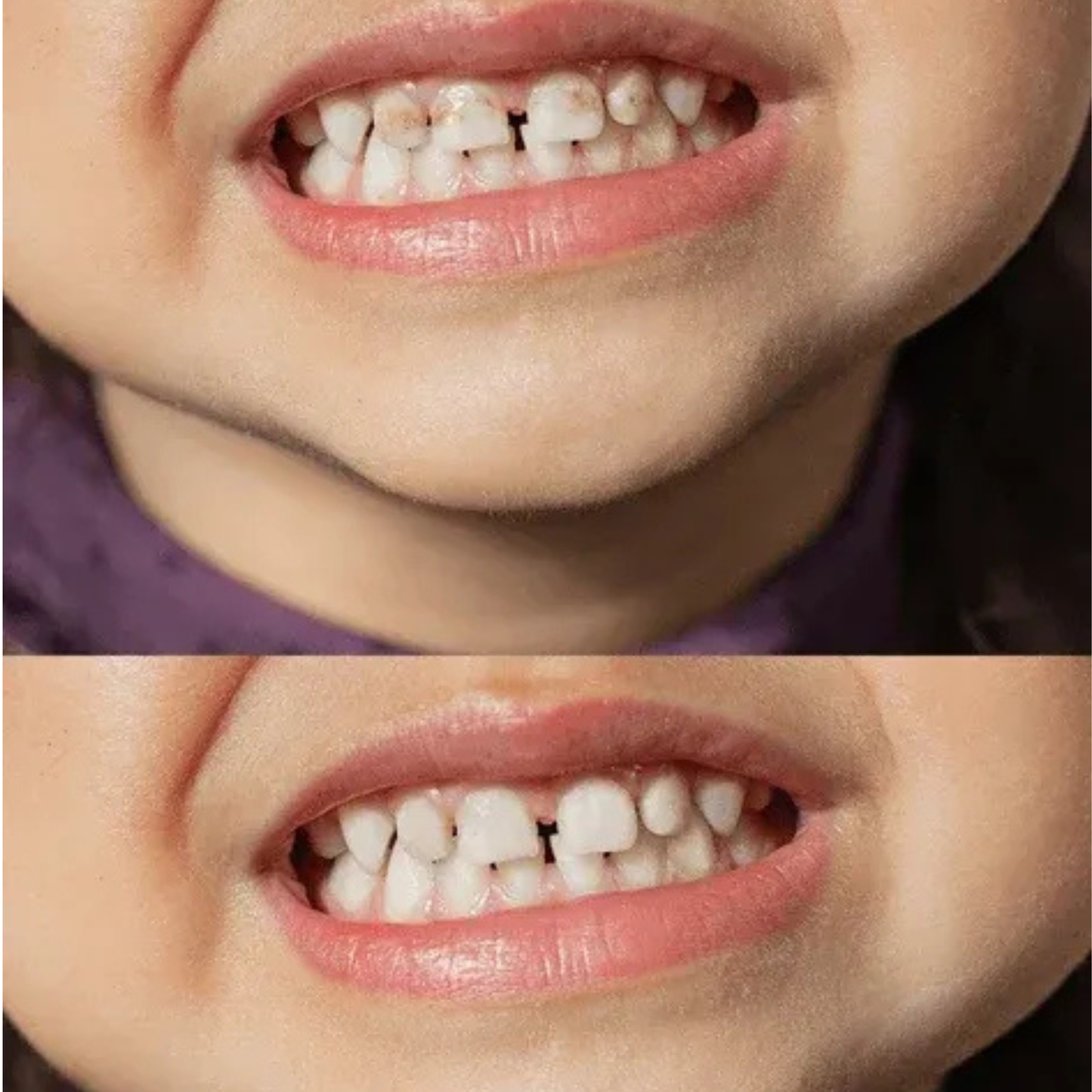 Smilify™ Kids Toothbrush