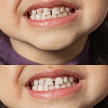 Smilify™ Kids Toothbrush